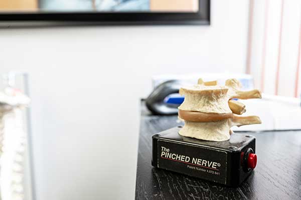 Photo of doctor's desk with demonstration of how a nerve becomes pinched.